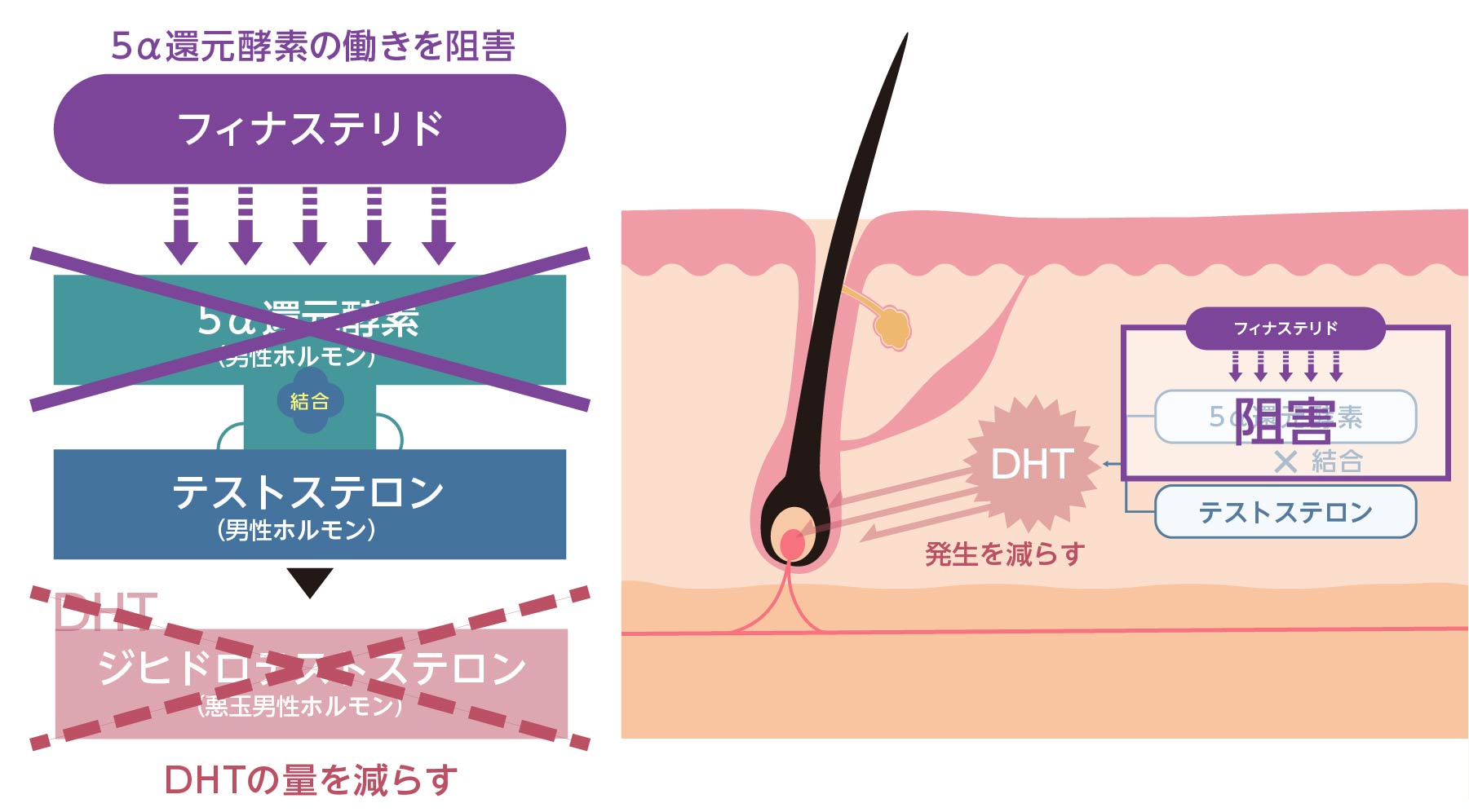 フィナステリドの作用