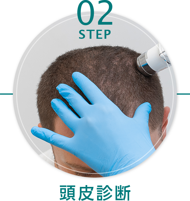 STEP 2：頭皮診断