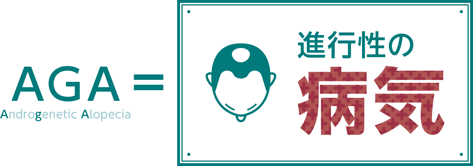 AGAは進行性の病気