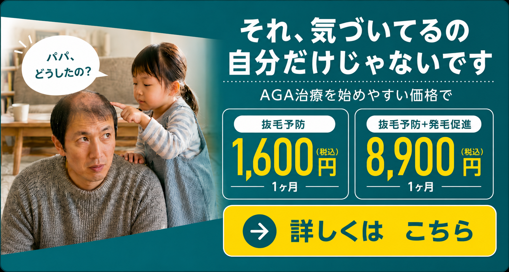 AGA治療を始めやすい価格で。抜毛予防は1ヶ月1,600円、抜毛予防+発毛促進は1ヶ月8,900円。詳しくはこちら。