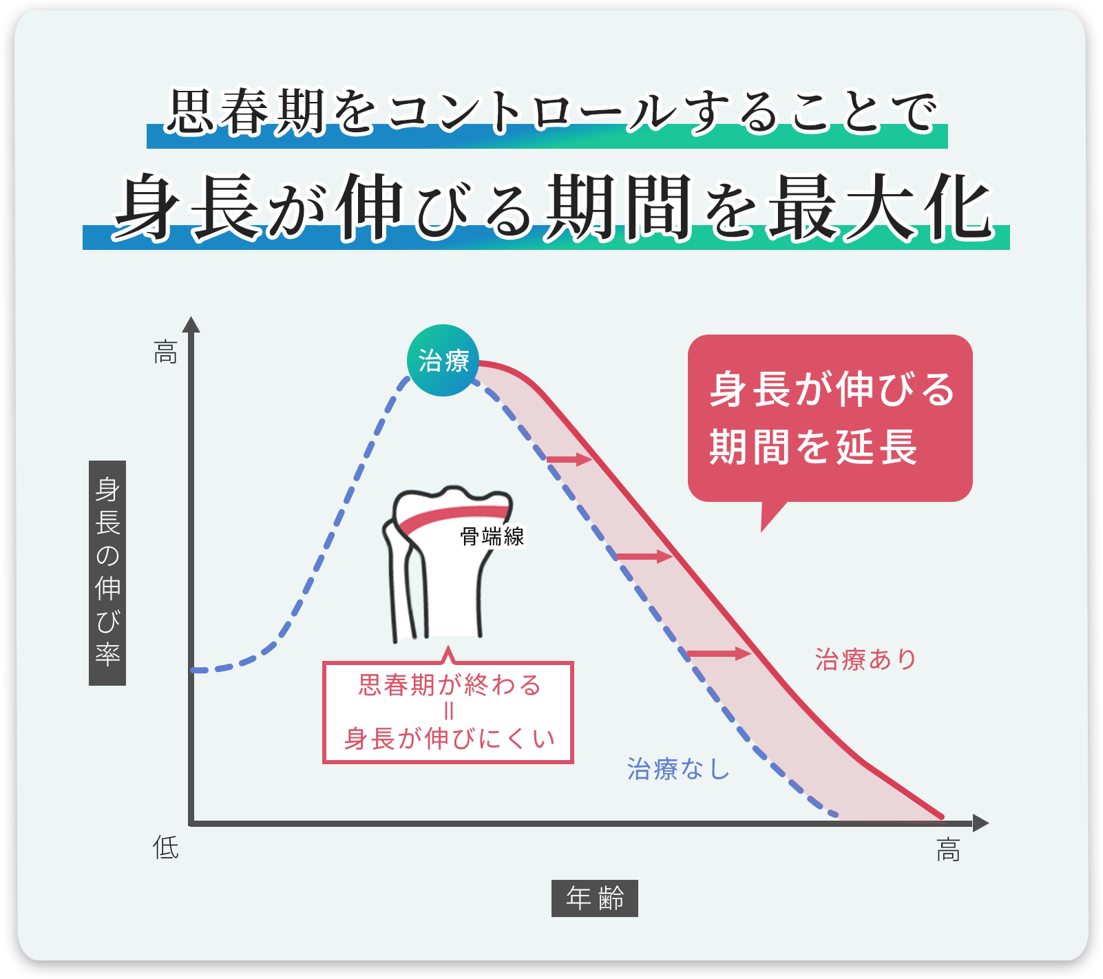 思春期をコントロールすることで身長が伸びる期間を最大化