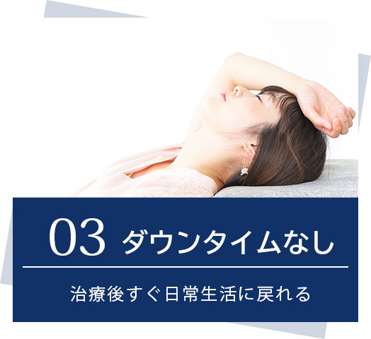 03.ダウンタイムなし