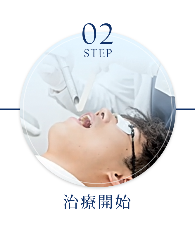 STEP 2：治療開始
