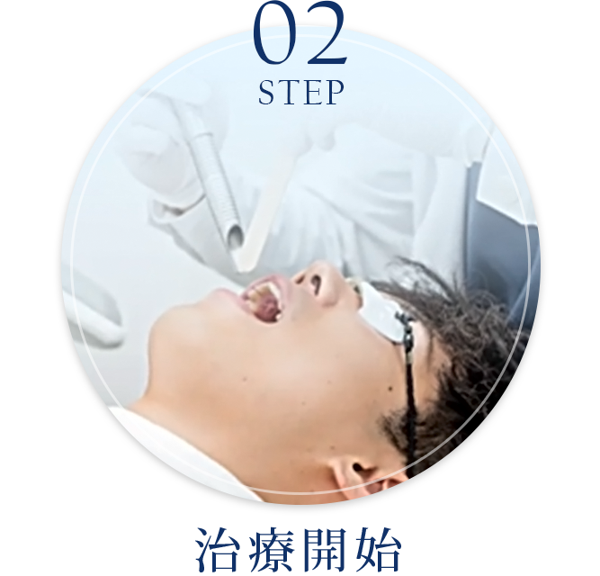 STEP 2：治療開始