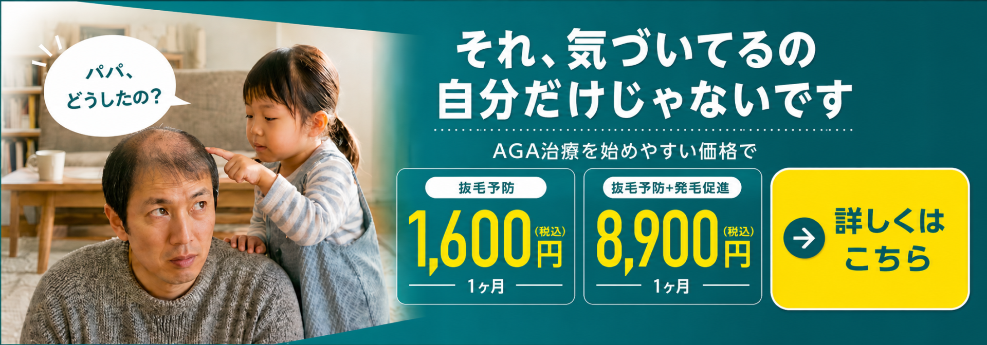 AGA治療を始めやすい価格で。抜毛予防は1ヶ月1,600円、抜毛予防＋発毛促進は1ヶ月8,900円。詳しくはこちら。